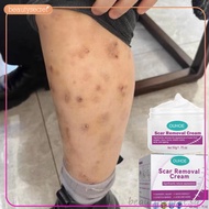 Cream Eliminate Black Scars Remove Old Wounds Mosquito Bite Scar Keloid Scar Burns Scal -beauty