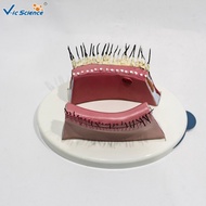 Enlarged Eye anatomical model blepharitis model