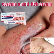 eczema cream anti-itch cream 20g antibacterial relief itchy redness psoriasis cream skin rash treatm