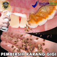 Plaque Removal Tartar Remover Spray Karang gigi remover teeth whitening jaysuing toothpaste gigi kun