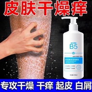 B5 Body Lotion Dry Itchy Whole Body Dry Skin Itchy Autumn Winter Dry Skin Moisturizing Moisturizing 