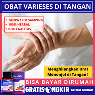 Obat Varises di Tangan Obat Penghilang Urat Menonjol di Tangan Obat Parises Pengempis Varises Obat U