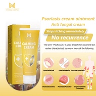 Dermovate cream Dermovate ointment Anti fungal cream Eczema cream Psoriasis crea Anti itch cream 20g