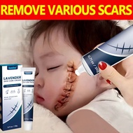 Scar Removal Cream Keloid Scar Remover 0g Repairs Surgical Scars Smoothes Skin Fade Scars Scar Remov