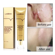 LANBENA Acne Scar Removal Cream Against Black Dots Scar Removal Facial Blackhead Acne Treatment