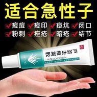 Aloe Vera Acne Removal Cream Aloe Vera Gel Acne Removal Reduce Acne Marks#芦荟祛痘膏芦荟胶祛痘淡化痘印