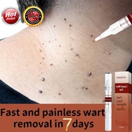 Skin tag remover Wart remover Mole removal Warts removal cream Ketuat remover Tag solution Warts and