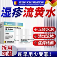 新品现货湿疹流黄水疮脓疱疮水泡湿疹渗液溃烂流脓瘙痒结痂ZPeczema flow yellow water sore impetigo blister eczema exudate20251104