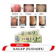Salep Gatal Jamur Panu Kadas Ruam Eksim Selangkangan - ZUDAIFU Gatal Gatal Terbaik