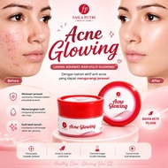 FAILA PUTRI ACNE GLOWING / KRIM MALAM JERAWAT FP BPOM