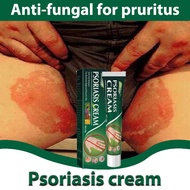 Eczema cream antibacterial cream psoriasis cream ointment original dermovate cream 20g