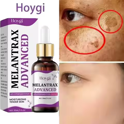 Hoygi Niacinamide Facial Serum Vitamin B3 Wrinkles Pigment Dark Spot Removal Correcting Glow Serum F