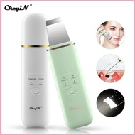 【Spot goods】❀☃CkeyiN Rechargeable Facial Skin Scrubber Spatula Ultrasonic EMS Ion Facail Cleanr Blac