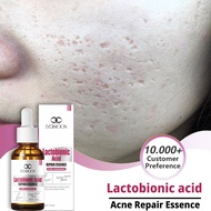Acne scar Acne spot treatment Acne scar removal Shrink Pore Oil Control Moisturizing Facial Cream Ac