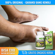 Obat Kaki Bengkak BPOM Obat Kaki Bengkak Akibat Asam Urat Obat Kaki Bengkak Karena Diabetes Obat Kaki Bengkak Karena Jantung Obat Kaki Bengkak Karena Ginjal - Keloreena