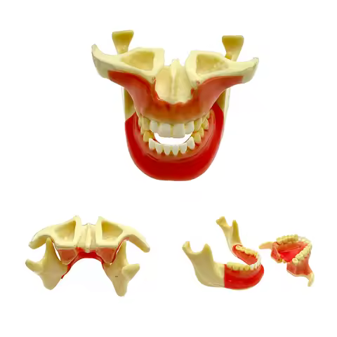Ortho Implant Model Dental Study Teaching Exercise for Student Pathological Demonstration Teeth Mode