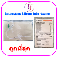 สายให้อาหารทางหน้าท้อง Gastrostomy Silicone Tube (PEG Tube) - Avanos