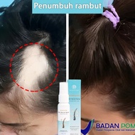Ada (BPOM)Serum penumbuh rambut Obat penumbuh rambut Penumbuh rambut