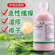 Eczema 100ml Lotion Furnace Sweet Stone-Based Furnace Sweet Stone Itching Rapid Hua 9cc Prickly Heat