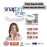 Snap On Smile Veneers Gigi Perfect Smile Original