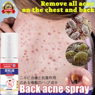 Back acne spray 60ml body acne sprayspot  acne acne scar Get rid of all pimples on your chest and ba