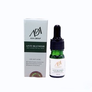 [MỸ PHẨM ADA CHÍNH HÃNG]  Bộ Đôi Serum mụn ANTI BLEMISH-ANTI ACNE 10+ Giúp bạn Tự Tin Sạch mụn 100%