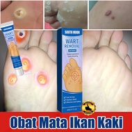 Ubat ketuat Wart removal Ubat Mata Ikan Skin tag remover Ubat ketuat tapak kaki Krim Ketuat dan Kuti