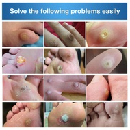 Penampal ketuat /ubat ketuat /Warts Remover Pad /Corn Remover Pad ALIVER ORIGINAL