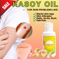 Kasoy Oil Wart Removal Original  Body Care Tanggal NUNAL, KULUGO, SKINTAGS, WARTS Peklat Remover oil