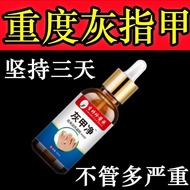 Li Shizhen Onychomycosychomycosychomycosychomycosychomycosychomycosychomycosychomycosychomycosychomy