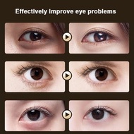Eye cream dark circle eye care eye cream eye bag 40ml anti-dark circle eye bag ointment eye essence 