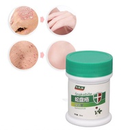 Chicken Pox Treatment Cream  Herpes Zoster Relieve Itching for Sub Health Elderly