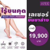 [E-Voucher] APEX เลเซอร์กำจัดขน เฉพาะขาส่วนล่าง แพ็คเก็จรายปี