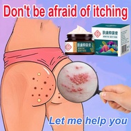 Official Authentic Itching cream private part Krim gatal Psoriasis Eczema cream 抑菌止痒膏 Antibacterial 