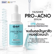 ยันฮี โปร เอกโน่ เซรั่ม Yanhee Pro Acno Serum ผลิตภัณฑ์เวชสำอางค์จากโรงพยาบาลยันฮี สิว รอยสิว พร้อมส่งฟรี