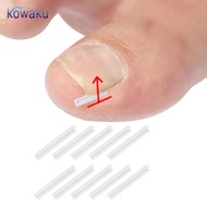 [vsrhkq] 10x Ingrown Toenail Corrector Strips Curved Toenail Corrector Treatment Men