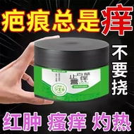 Scars Always Itch Repeatedly Itchy Growth Skin Scars Trauma Scars Itchy Scars Itchy Cream Skin