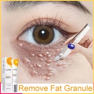 Vitamin C eye cream fat particles dark circle eye bag remover anti-puffiness anti-wrinkle eye serum instant firm brightening anti aging moisturizer 20g