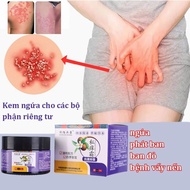 Ringworm Skin Cream 30g Itchy Cream Japanese Itchy Fungus Cream Itchy Skin Cream Ringworm Itchy Skin