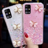 CASING COMPATIBLE SAMSUNG A56 A36 A06 M15 S24FE A35 5G A55 A51 4G A32 5G M32 5G M52 5G CASING GLITTE