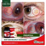 OilFit - Obat Pinguecula Benjolan Bintik Kuning Di Mata OilFit 50 Kapsul 100% Minyak Buah Merah Papu