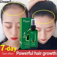 Hair Growth Nutrition Tonic/Serum/Spray 120ml - Strong Hair, Anti-Hair Loss, Scalp Massage, Damage R