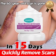 Scar Removal Cream For New & Old Scars Remove Stretch Mark Scar Scar Removal Cream Remover Cream Sca
