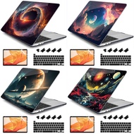 4 In 1 Starry Laptop Hard Case+Keyboard Cover+Dust Plug+Screen Protector For Macbook 11 12 13 14 15 