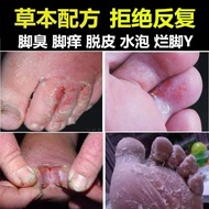 Foot Head Tube 1+1 Spray Combination Itchy Foot Odor Foot Odor Foot Socks Deodorant Foot Head Tube S