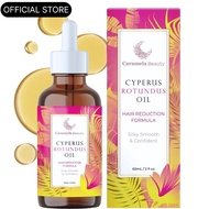 CaramelaBeauty Herbal Essential Oil, Used to Reduce Hair Falling off-60ml/2oz, 0O49.