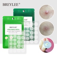 VARIVIDA BREYLEE [Stock] 22Patches/Pack Acne Pimple Patch Acne Treatment Stickers Pimple Remover Too