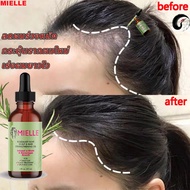 ✅แท้จากUSA💯% MIELLE Rosemary Mint Scalp & Hair Strengthening Oil Growth Serum 2oz 59ml น้ำมันบำรุงผม