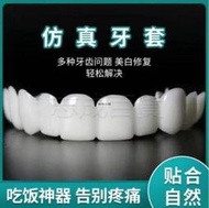 防真牙齒美白牙套 假牙套假牙臨時模型