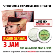 Krim Gatal Adam Dan Hawa Krim Penjagaan Kulit Gatal Ruam Kulit Kering
